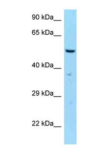 SAS6 / SASS6 Antibody - SASS6 antibody Western blot of MCF7 Cell lysate. Antibody concentration 1 ug/ml.  This image was taken for the unconjugated form of this product. Other forms have not been tested.