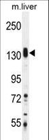 SASH1 Antibody - SASH1 Antibody western blot of mouse liver tissue lysates (35 ug/lane). The SASH1 antibody detected the SASH1 protein (arrow).