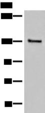 SASH1 Antibody - Western blot analysis of Human urinary bladder tissue lysate  using SASH1 Polyclonal Antibody at dilution of 1:300