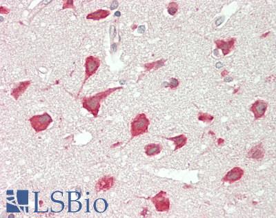 SAT1 / SAT Antibody - Human Brain, Cortex: Formalin-Fixed, Paraffin-Embedded (FFPE).  This image was taken for the unconjugated form of this product. Other forms have not been tested.