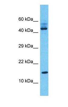 SAT2 Antibody - Western blot of SAT2 Antibody with THP-1 Whole Cell lysate.  This image was taken for the unconjugated form of this product. Other forms have not been tested.