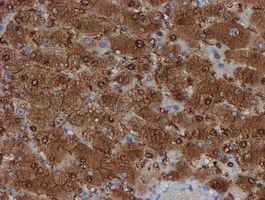 SAT2 Antibody - IHC of paraffin-embedded Human liver tissue using anti-SAT2 mouse monoclonal antibody.