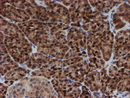 SAT2 Antibody - IHC of paraffin-embedded Human pancreas tissue using anti-SAT2 mouse monoclonal antibody.