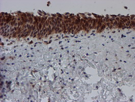 SAT2 Antibody - IHC of paraffin-embedded Human bladder tissue using anti-SAT2 mouse monoclonal antibody.