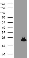 SAT2 Antibody - HEK293T cells were transfected with the pCMV6-ENTRY control (Left lane) or pCMV6-ENTRY SAT2 (Right lane) cDNA for 48 hrs and lysed. Equivalent amounts of cell lysates (5 ug per lane) were separated by SDS-PAGE and immunoblotted with anti-SAT2.