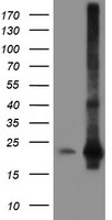 SAT2 Antibody - HEK293T cells were transfected with the pCMV6-ENTRY control (Left lane) or pCMV6-ENTRY SAT2 (Right lane) cDNA for 48 hrs and lysed. Equivalent amounts of cell lysates (5 ug per lane) were separated by SDS-PAGE and immunoblotted with anti-SAT2.