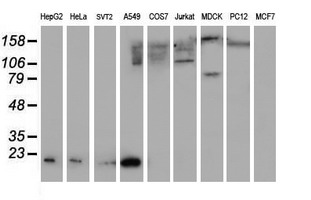 SAT2 Antibody - Western blot of extracts (35ug) from 9 different cell lines by using anti-SAT2 monoclonal antibody (HepG2: human; HeLa: human; SVT2: mouse; A549: human; COS7: monkey; Jurkat: human; MDCK: canine; PC12: rat; MCF7: human).