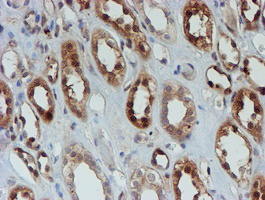 SAT2 Antibody - IHC of paraffin-embedded Human Kidney tissue using anti-SAT2 mouse monoclonal antibody. (Heat-induced epitope retrieval by 10mM citric buffer, pH6.0, 100C for 10min).