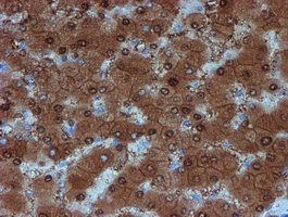 SAT2 Antibody - IHC of paraffin-embedded Human liver tissue using anti-SAT2 mouse monoclonal antibody. (Heat-induced epitope retrieval by 10mM citric buffer, pH6.0, 100C for 10min).