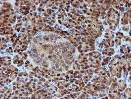 SAT2 Antibody - IHC of paraffin-embedded Human pancreas tissue using anti-SAT2 mouse monoclonal antibody. (Heat-induced epitope retrieval by 10mM citric buffer, pH6.0, 100C for 10min).