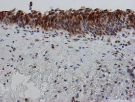 SAT2 Antibody - IHC of paraffin-embedded Human bladder tissue using anti-SAT2 mouse monoclonal antibody. (Heat-induced epitope retrieval by 10mM citric buffer, pH6.0, 100C for 10min).