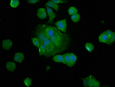 SAT2 Antibody - Immunofluorescence staining of MCF-7 cells at a dilution of 1:133, counter-stained with DAPI. The cells were fixed in 4% formaldehyde, permeabilized using 0.2% Triton X-100 and blocked in 10% normal Goat Serum. The cells were then incubated with the antibody overnight at 4 °C.The secondary antibody was Alexa Fluor 488-congugated AffiniPure Goat Anti-Rabbit IgG (H+L) .