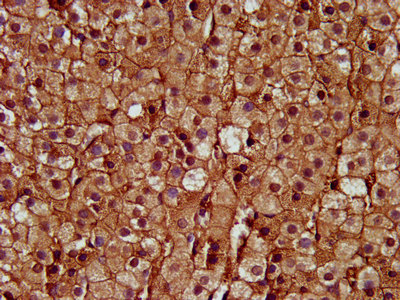 SAT2 Antibody - Immunohistochemistry image at a dilution of 1:400 and staining in paraffin-embedded human adrenal gland tissue performed on a Leica BondTM system. After dewaxing and hydration, antigen retrieval was mediated by high pressure in a citrate buffer (pH 6.0) . Section was blocked with 10% normal goat serum 30min at RT. Then primary antibody (1% BSA) was incubated at 4 °C overnight. The primary is detected by a biotinylated secondary antibody and visualized using an HRP conjugated SP system.