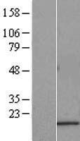 SAT2 Protein - Western validation with an anti-DDK antibody * L: Control HEK293 lysate R: Over-expression lysate