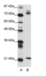 SATB1 Antibody - A: Marker, B: Transfected 293T Cell Lysate.  This image was taken for the unconjugated form of this product. Other forms have not been tested.