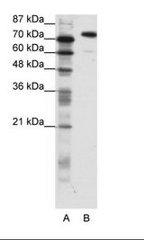 SATB1 Antibody - A: Marker, B: Jurkat Cell Lysate.  This image was taken for the unconjugated form of this product. Other forms have not been tested.