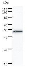 SATB1 Antibody - Western blot of immunized recombinant protein using SATB1 antibody.