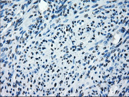 SATB1 Antibody - IHC of paraffin-embedded endometrium tissue using anti-SATB1 mouse monoclonal antibody. (Dilution 1:50).