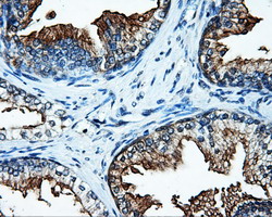 SATB1 Antibody - IHC of paraffin-embedded prostate tissue using anti-SATB1 mouse monoclonal antibody. (Dilution 1:50).
