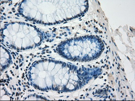 SATB1 Antibody - IHC of paraffin-embedded colon tissue using anti-SATB1 mouse monoclonal antibody. (Dilution 1:50).