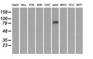 SATB1 Antibody - Western blot of extracts (35 ug) from 9 different cell lines by using anti-SATB1 monoclonal antibody.