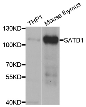 SATB1 Antibody - Western blot analysis of extracts of various cell lines.