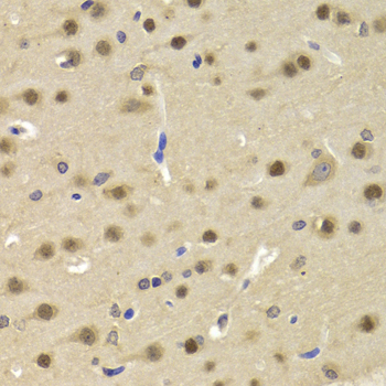 SATB1 Antibody - Immunohistochemistry of paraffin-embedded Rat brain tissue.