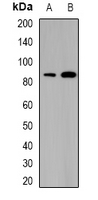 SATB1 Antibody - Western blot analysis of SATB1 expression in THP1 (A); mouse thymus (B) whole cell lysates.