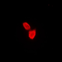 SATB1 Antibody - Immunofluorescent analysis of SATB1 staining in A549 cells. Formalin-fixed cells were permeabilized with 0.1% Triton X-100 in TBS for 5-10 minutes and blocked with 3% BSA-PBS for 30 minutes at room temperature. Cells were probed with the primary antibody in 3% BSA-PBS and incubated overnight at 4 deg C in a humidified chamber. Cells were washed with PBST and incubated with a DyLight 594-conjugated secondary antibody (red) in PBS at room temperature in the dark.