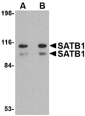 SATB1 Antibody - Western blot of SATB1 in SK-N-SH cell lysate with SATB1 antibody at (A) 1 and (B) 2 ug/ml.