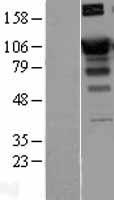 SATB1 Protein - Western validation with an anti-DDK antibody * L: Control HEK293 lysate R: Over-expression lysate