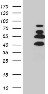SATB2 Antibody - HEK293T cells were transfected with the pCMV6-ENTRY control. (Left lane) or pCMV6-ENTRY SATB2. (Right lane) cDNA for 48 hrs and lysed. Equivalent amounts of cell lysates. (5 ug per lane) were separated by SDS-PAGE and immunoblotted with anti-SATB2. (1:2000)