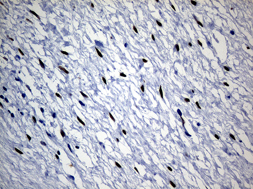 SATB2 Antibody - Immunohistochemical staining of paraffin-embedded Human muscle tissue within the normal limits using anti-SATB2 mouse monoclonal antibody. (Heat-induced epitope retrieval by 1mM EDTA in 10mM Tris buffer. (pH8.5) at 120 oC for 3 min. (1:150)