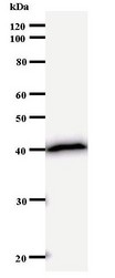 SATB2 Antibody - Western blot of immunized recombinant protein using SATB2 antibody.