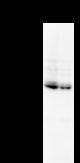 SATB2 Antibody - Detection of SATB2 by Western blot. Samples: Whole cell lysate from human HT1080 (H, 25 ug) and mouse NIH3T3 (M, 25 ug) cells. Predicted molecular weight: 82 kDa