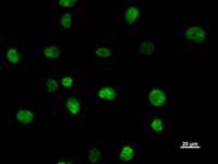 SATB2 Antibody - Immunostaining analysis in HT1080 cells. HT1080 cells were fixed with 4% paraformaldehyde and permeabilized with 0.1% Triton X-100 in PBS. The cells were immunostained with anti-SATB2 mAb.