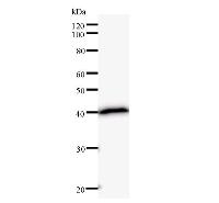 SATB2 Antibody - Western blot analysis of immunized recombinant protein, using anti-SATB2 monoclonal antibody.