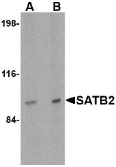 SATB2 Antibody - Western blot of SATB2 in mouse brain tissue lysate with SATB2 antibody at (A) 2 and (B) 4 ug/ml.