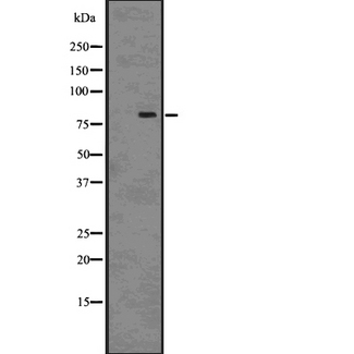 SATB2 Antibody - Western blot analysis SATB2 using HepG2 whole cells lysates