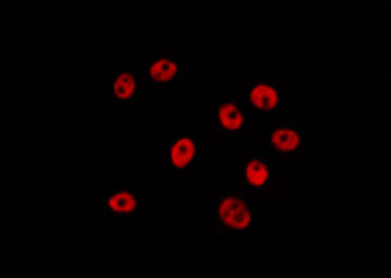 SATB2 Antibody - Staining U87 cells by IF/ICC. The samples were fixed with PFA and permeabilized in 0.1% Triton X-100, then blocked in 10% serum for 45 min at 25°C. The primary antibody was diluted at 1:200 and incubated with the sample for 1 hour at 37°C. An Alexa Fluor 594 conjugated goat anti-rabbit IgG (H+L) Ab, diluted at 1/600, was used as the secondary antibody.