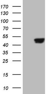 SAV1 / WW45 Antibody - HEK293T cells were transfected with the pCMV6-ENTRY control. (Left lane) or pCMV6-ENTRY SAV1. (Right lane) cDNA for 48 hrs and lysed. Equivalent amounts of cell lysates. (5 ug per lane) were separated by SDS-PAGE and immunoblotted with anti-SAV1.