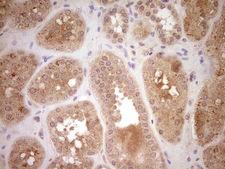 SAV1 / WW45 Antibody - Immunohistochemical staining of paraffin-embedded Human Kidney tissue within the normal limits using anti-SAV1 mouse monoclonal antibody. (Heat-induced epitope retrieval by Tris-EDTA, pH8.0) Dilution: 1:150
