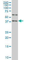 SAV1 / WW45 Antibody - SAV1 monoclonal antibody (M04), clone 3A10. Western blot of SAV1 expression in HeLa NE.
