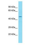 SAXO2 / FAM154B Antibody - FAM154B antibody Western Blot of Jurkat. Antibody dilution: 1 ug/ml.  This image was taken for the unconjugated form of this product. Other forms have not been tested.