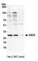SBDS Antibody - Detection of human SBDS by western blot. Samples: Whole cell lysate (50 µg) from HeLa, HEK293T, and Jurkat cells prepared using NETN lysis buffer. Antibody: Affinity purified rabbit anti-SBDS antibody used for WB at 0.1 µg/ml. Detection: Chemiluminescence with an exposure time of 10 seconds.