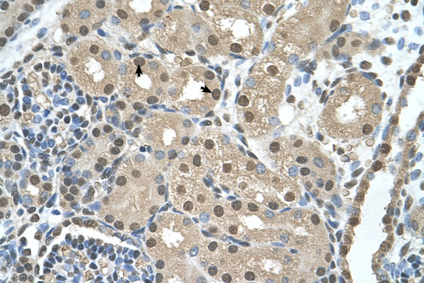 SBDS Antibody - SBDS antibody ARP45719_T100-NP_057122-SBDS(Shwachman-Bodian-Diamond syndrome) Antibody IHC of formalin-fixed, paraffin-embedded human Kidney. Positive label: Epithelial cells of renal tubule indicated with arrows. Antibody concentration 4-8 ug/ml. Magnification 400X.  This image was taken for the unconjugated form of this product. Other forms have not been tested.
