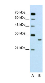 SBDS Antibody - SBDS antibody ARP45719_T100-NP_057122-SBDS(Shwachman-Bodian-Diamond syndrome) Antibody Western blot of Jurkat lysate.  This image was taken for the unconjugated form of this product. Other forms have not been tested.
