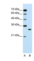 SBDS Antibody - SBDS antibody ARP45721_T100-NP_057122-SBDS(Shwachman-Bodian-Diamond syndrome) Antibody Western blot of Jurkat lysate.  This image was taken for the unconjugated form of this product. Other forms have not been tested.