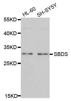 SBDS Antibody - Western blot analysis of extracts of various cell lines.