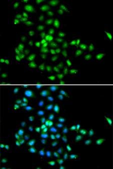 SBDS Antibody - Immunofluorescence analysis of MCF7 cells.